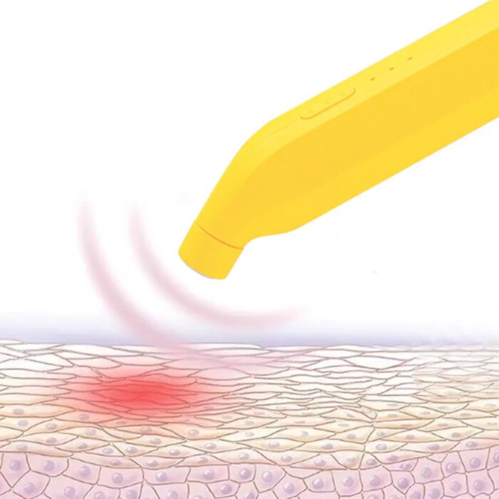 17487-qih1ys.jpg Detalhe da ponta de pulso térmico do curativo elétrico para picadas de insetos